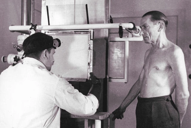 <p>Tuberkulose-Diagnostik 1951 in der DDR</p>